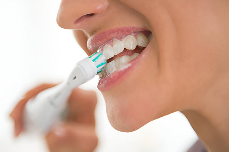  رعایت بهداشت دهان و دندان بعد از ایمپلنت از اهمیت زیادی برخوردار است. 